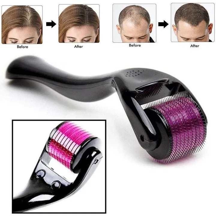 Derma Roller System 540 Microneedles – photo 4