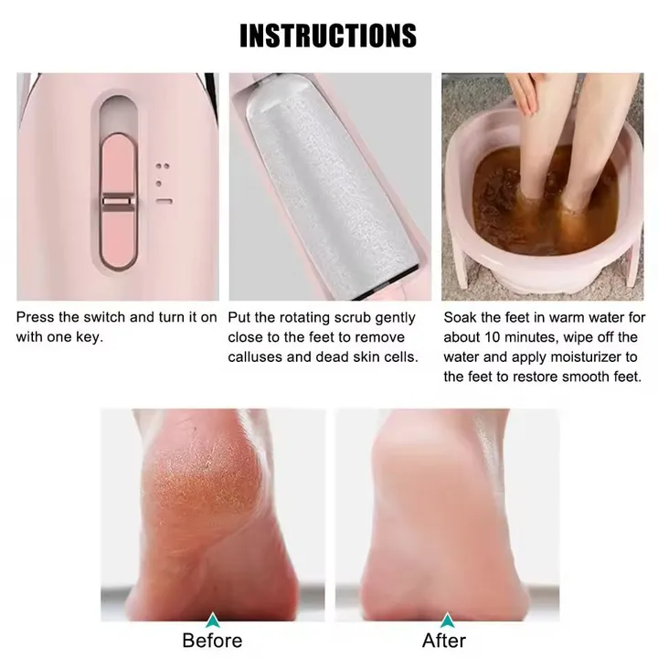 Electric Pedi Callus Remover – photo 4