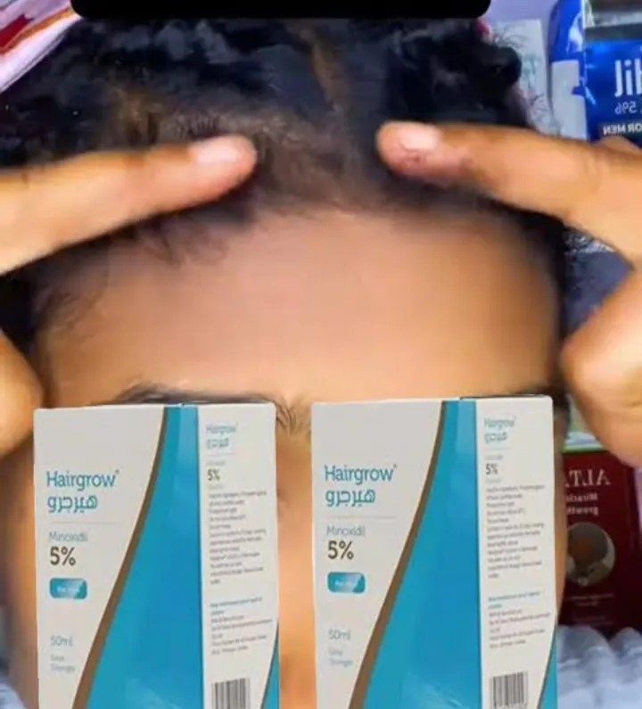 Hairgrow 5% Minoxidil Hair Treatment – photo 3
