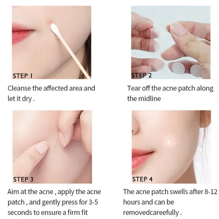 Hydrocolloid Acne Patch 144 Pcs – photo 5